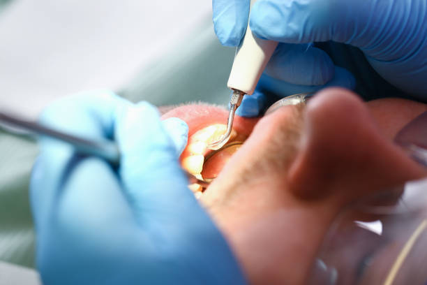 Best Emergency Treatment for Jaw Pain or Injury in Royal Pines, NC